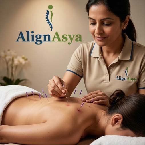 Dry Needling Therapy treatment image